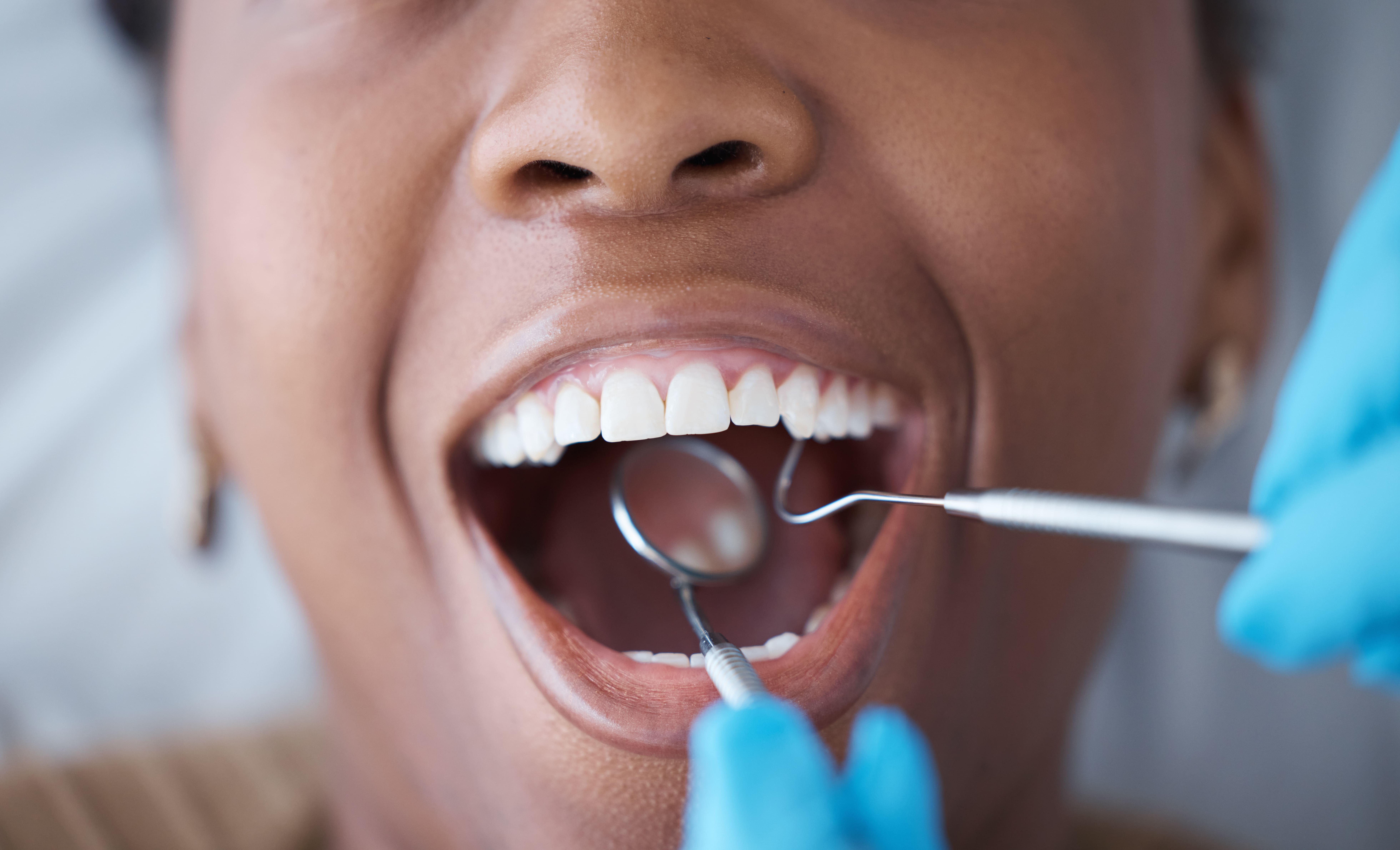 a-toothpain