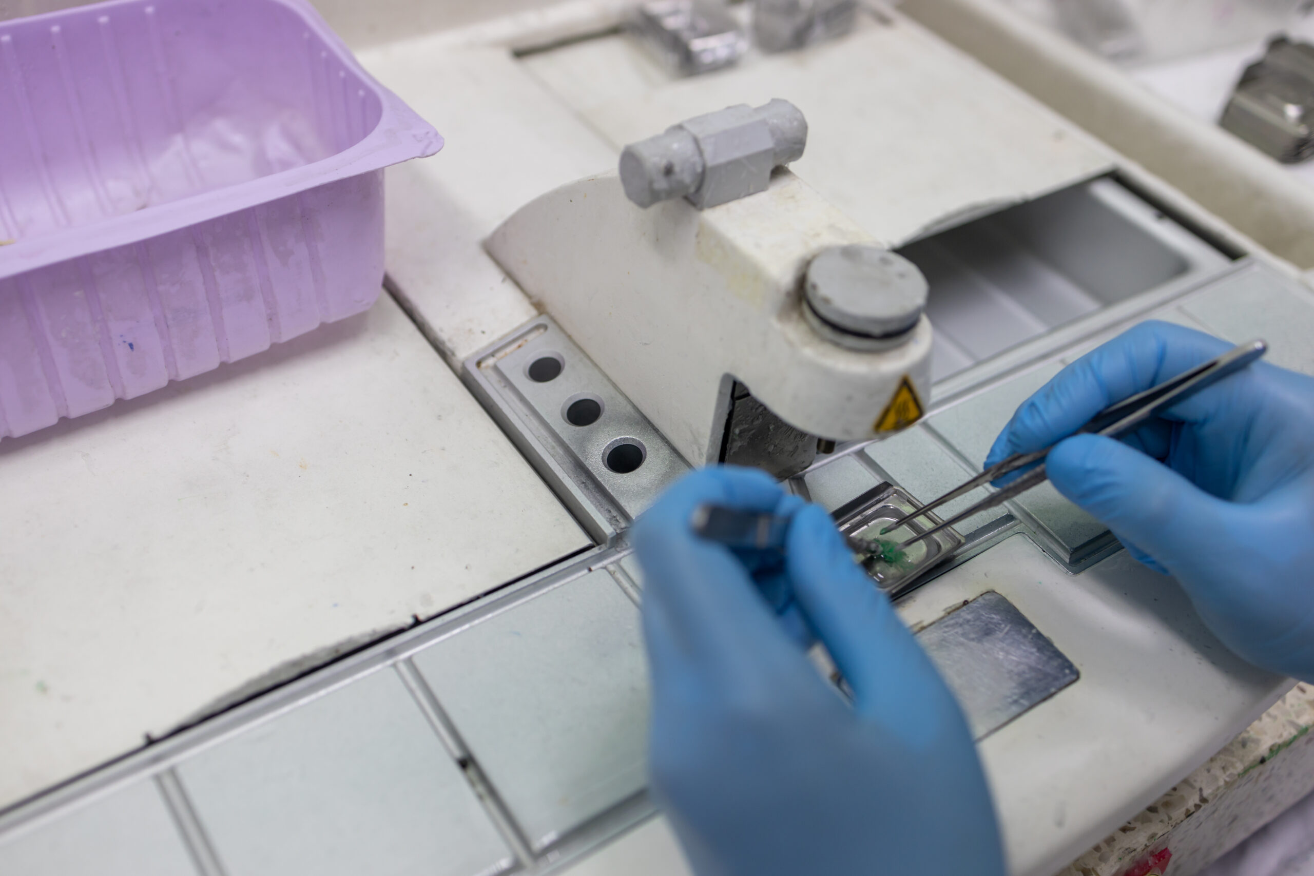 biopsies